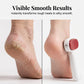 🏆 50% OFF NOW! 🦶 Double-Sided Foot Scraper – Removes calluses & dead skin easily – For smooth, baby-soft feet at home ✨